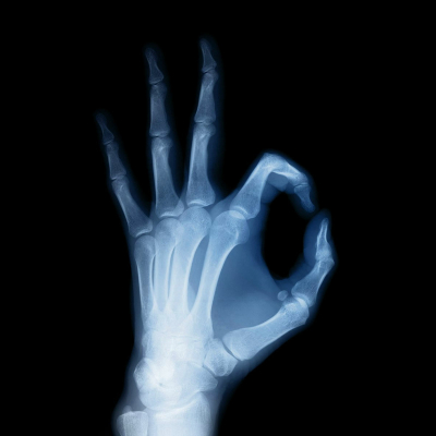 x-ray Pfp