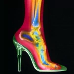  X-ray high heel