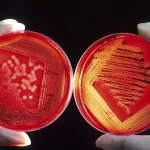  Agar Plate