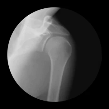 photography X-ray PFP